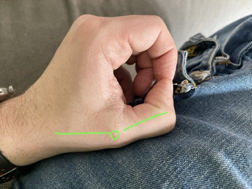 DBF6C89E-CE15-4422-B9BD-FA35A899748F.jpeg (122.38 KiB) Visto 854 volte Presa a pinzetta corretta