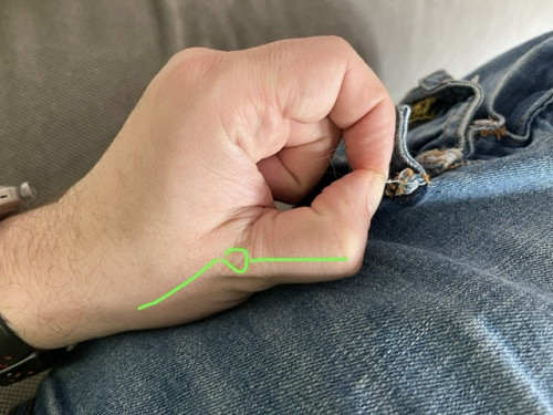 F5C6F527-161D-4874-BE87-22D05DE79885.jpeg (125.18 KiB) Visto 854 volte Presa a pinzetta con iperestensione del pollice (da evitare)